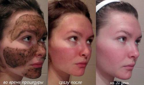 Применение маски из бадаги для лица