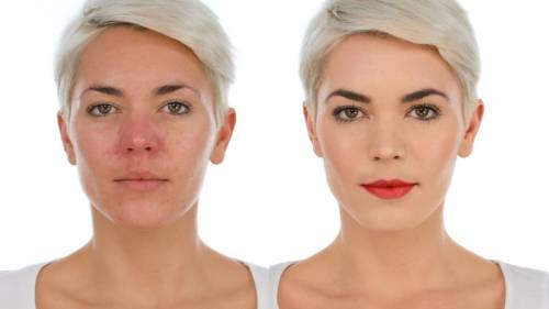 Лицо до и после применения профессиональной косметики