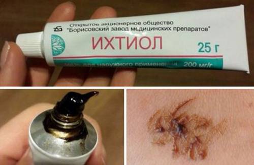 Ихтиоловая мазь