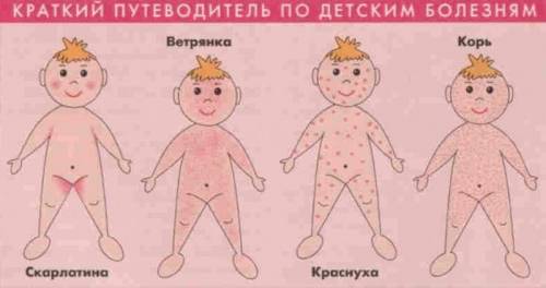 Сыпь при детских болезнях