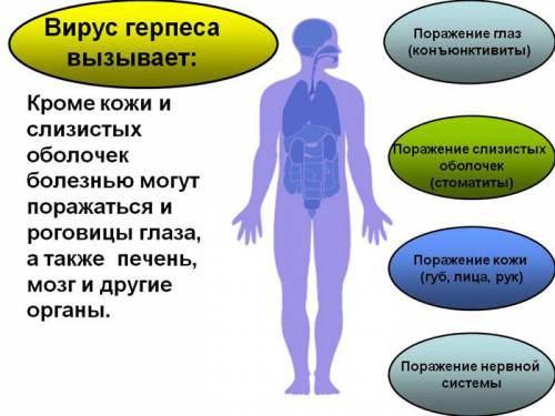 Зоны поражения вируса герпеса