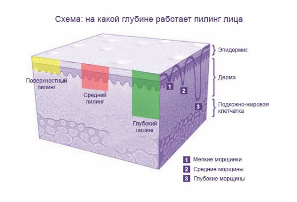 Схема глубины пилинга